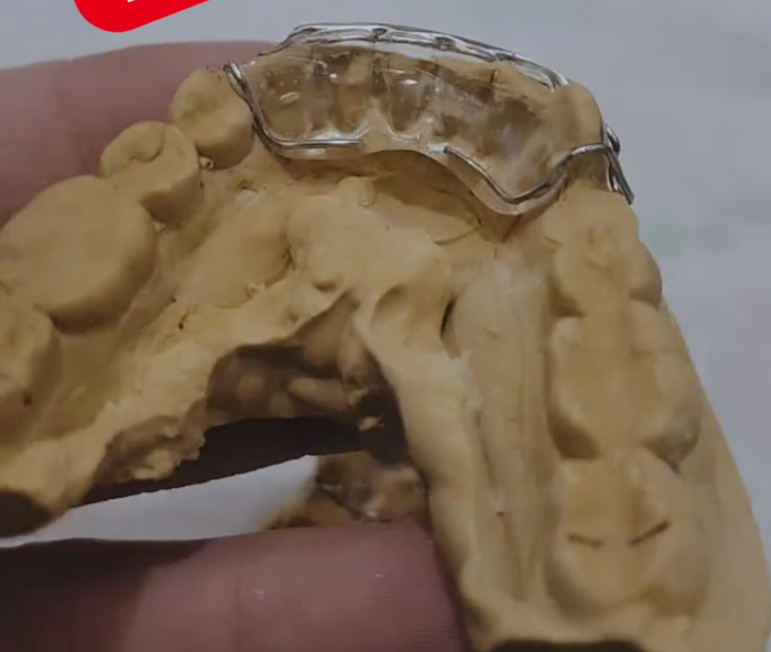 Lower Spring Aligner