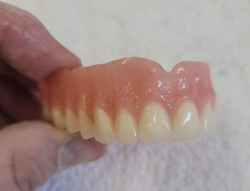 Dentures