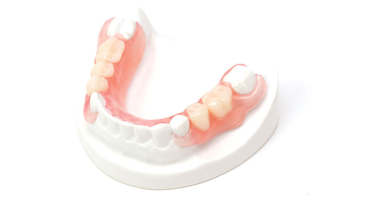 Flexible Partial Denture